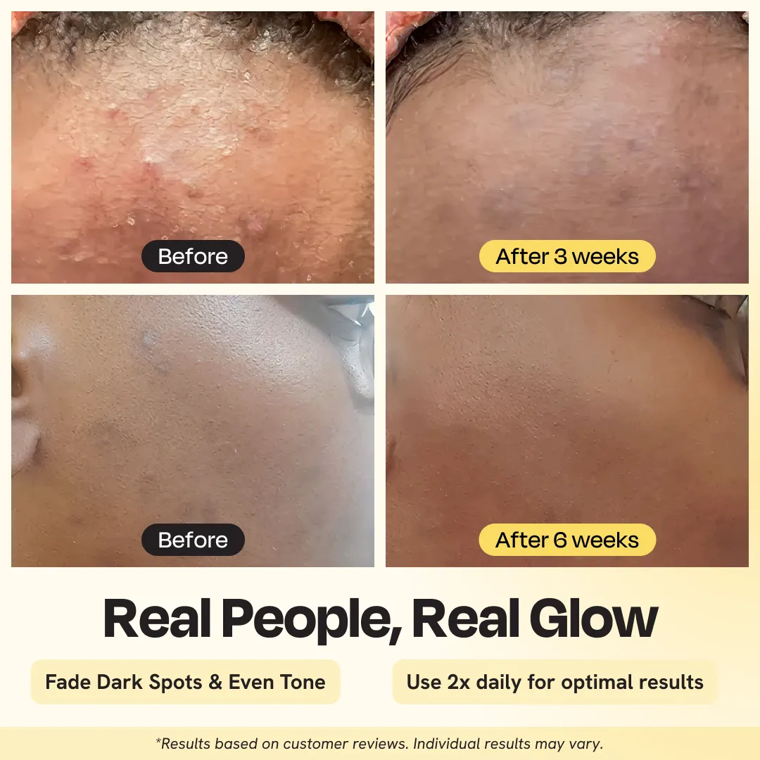 Advanced Brightening Moisturizer - Image 5