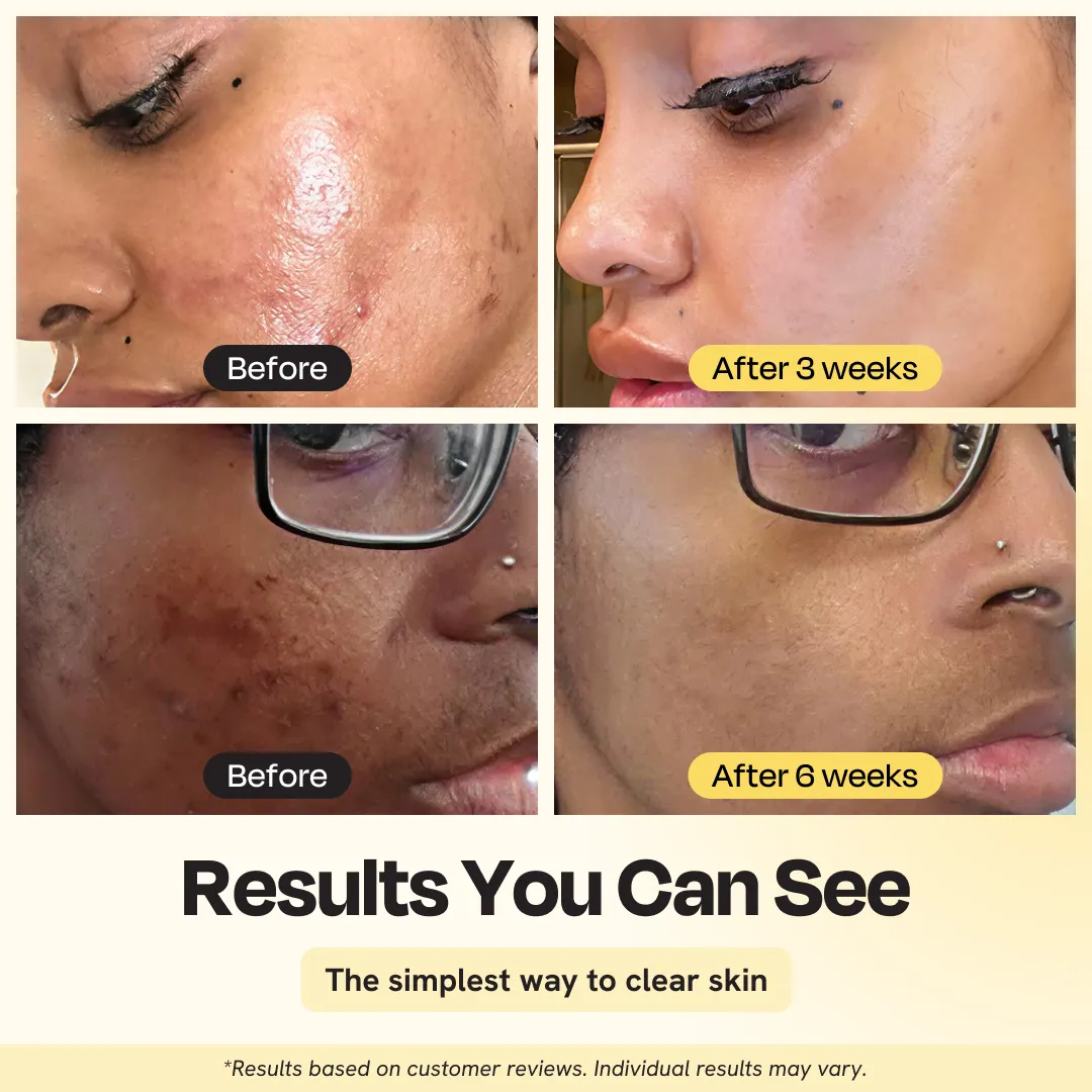 Jumbo Vitamin C Clay Mask - Image 3