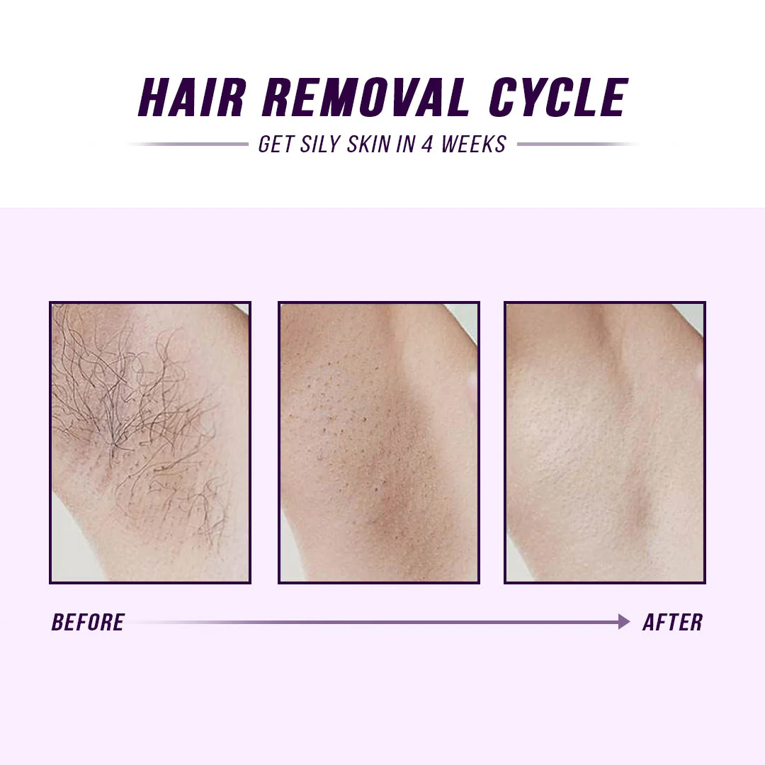 Laser IPL Hair Removal - Image 7
