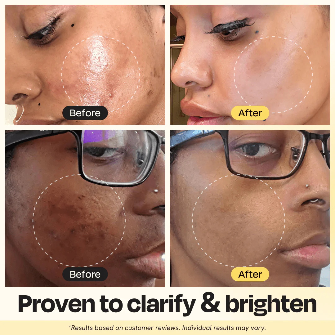 Vitamin C Clay Mask - Image 2