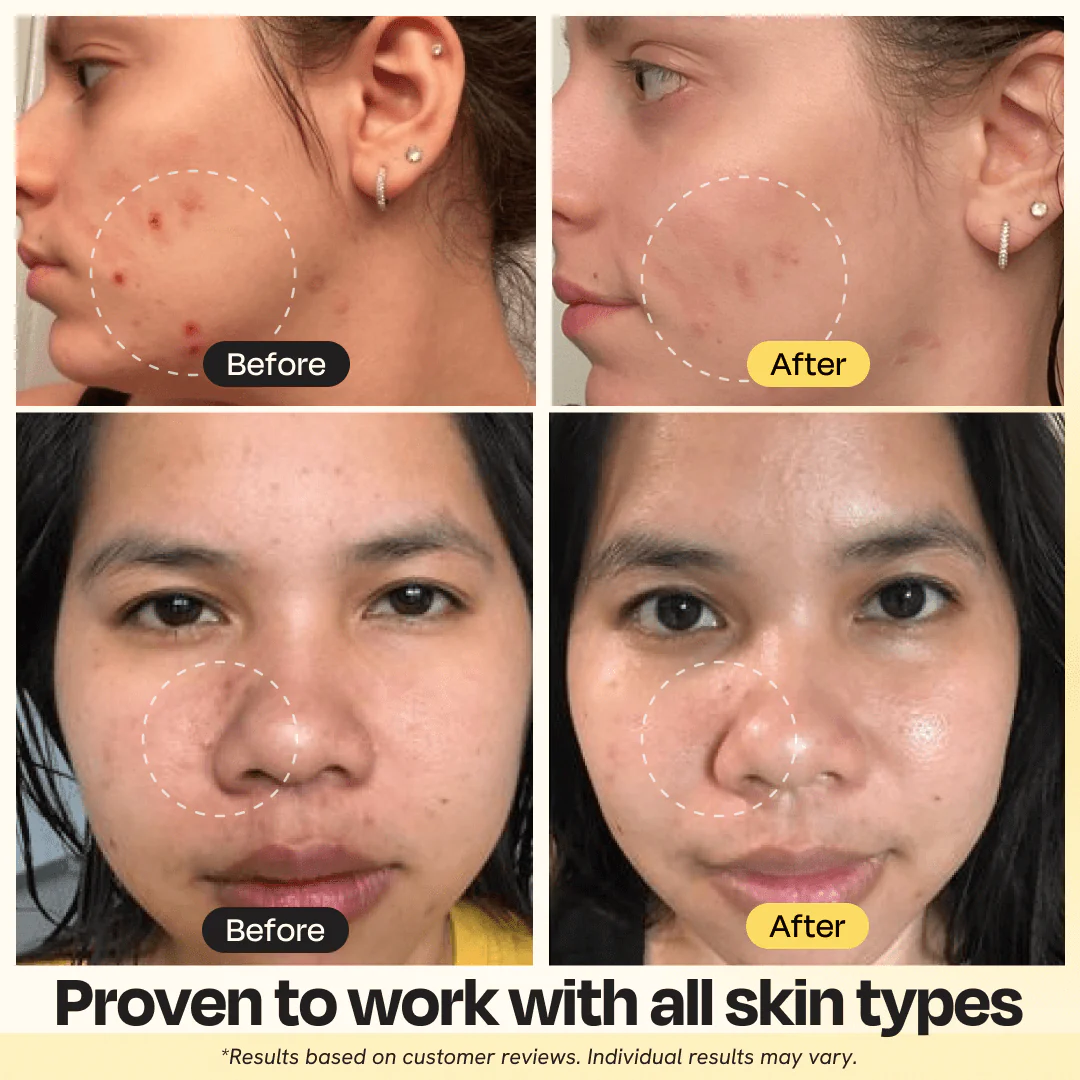 Vitamin C Clay Mask - Image 4